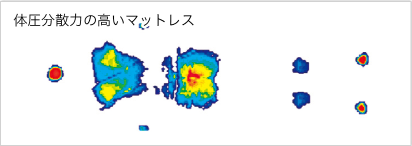 体圧分散力の低いマットレス 圧力マッピング